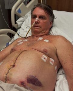  Após uma semana de internação, Bolsonaro escreve que está “estável e com a pressão controlada”; leia e veja foto